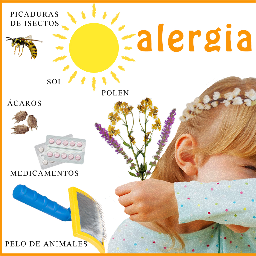 alergiaA